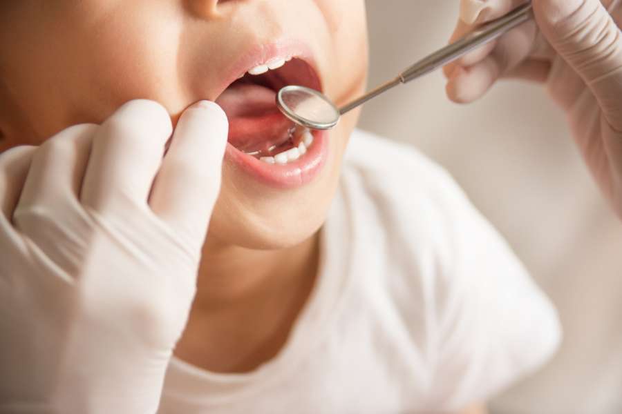 お子さまの歯の健康を守るために